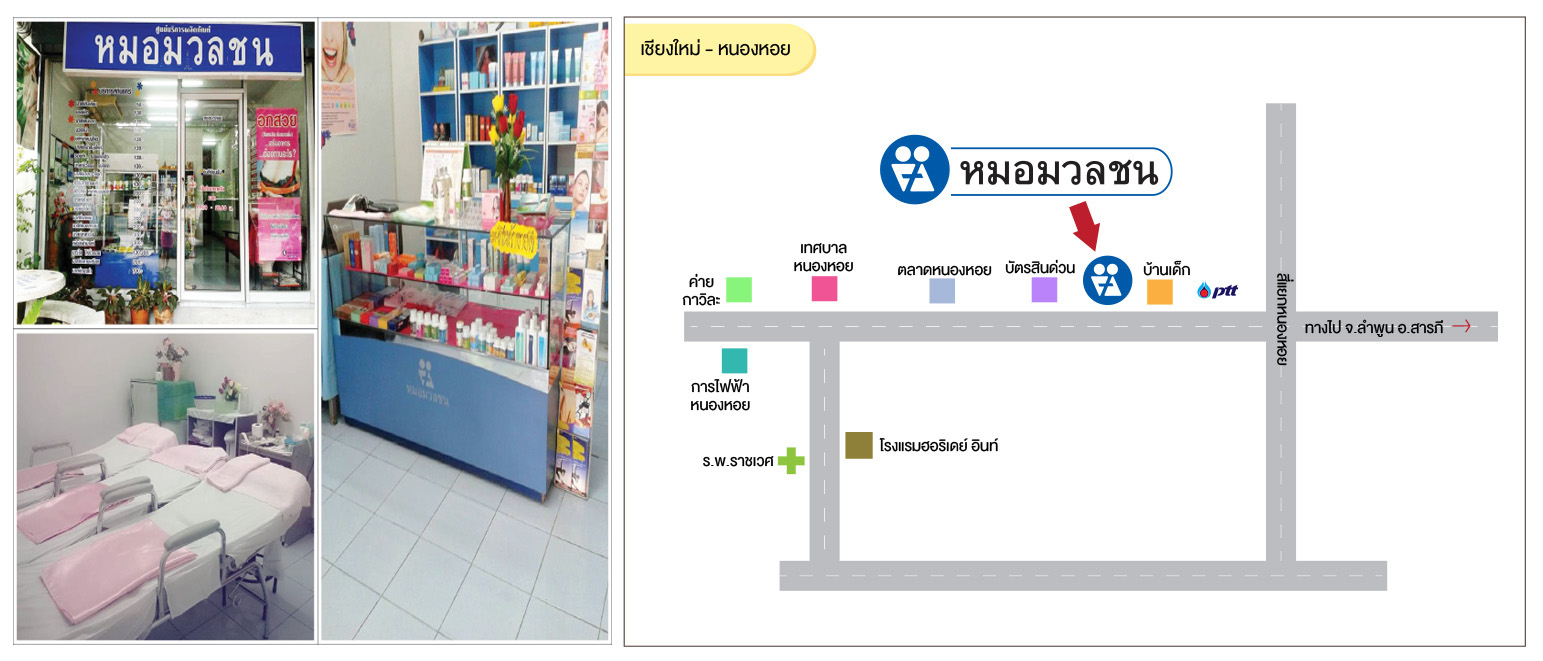 เชียงใหม่ - หนองหอย
