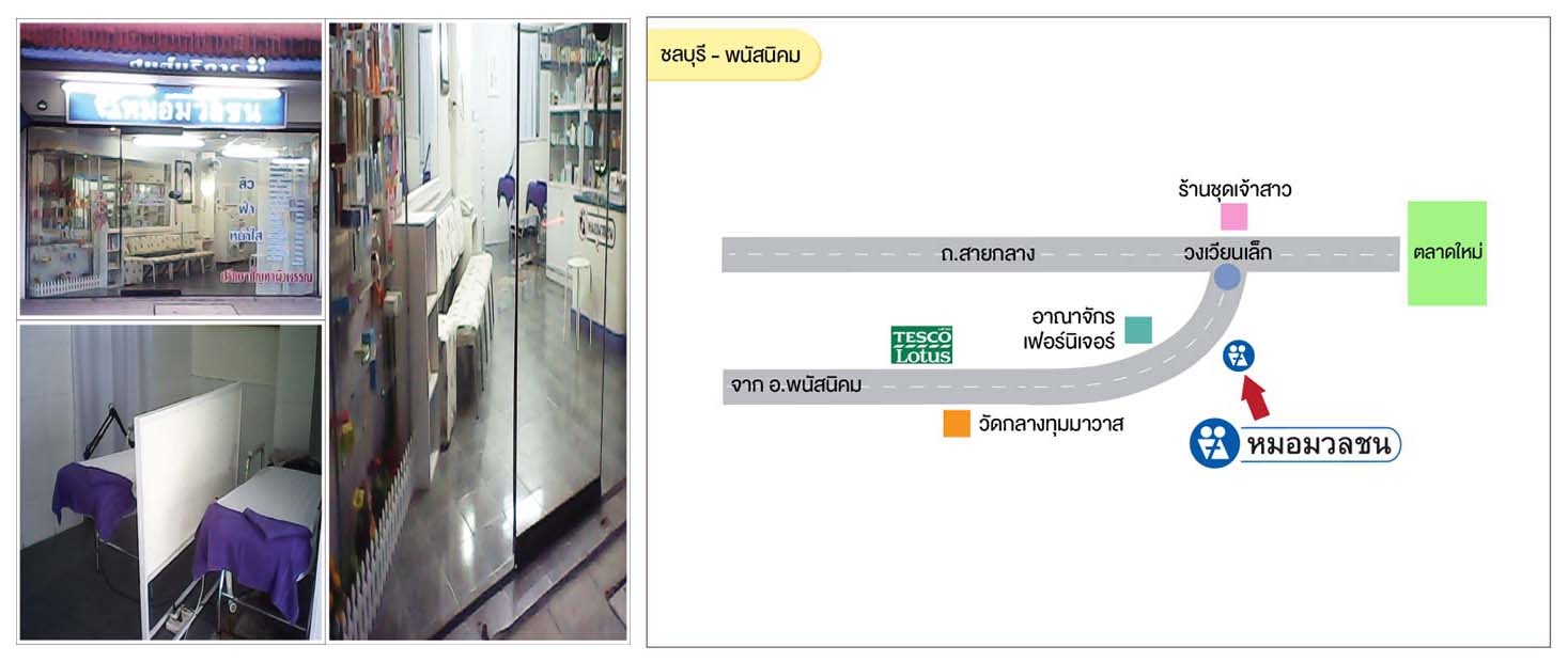 ศูนย์บริการผลิตภัณฑ์หมอมวลชน ชลบุรี พนัสนิคม