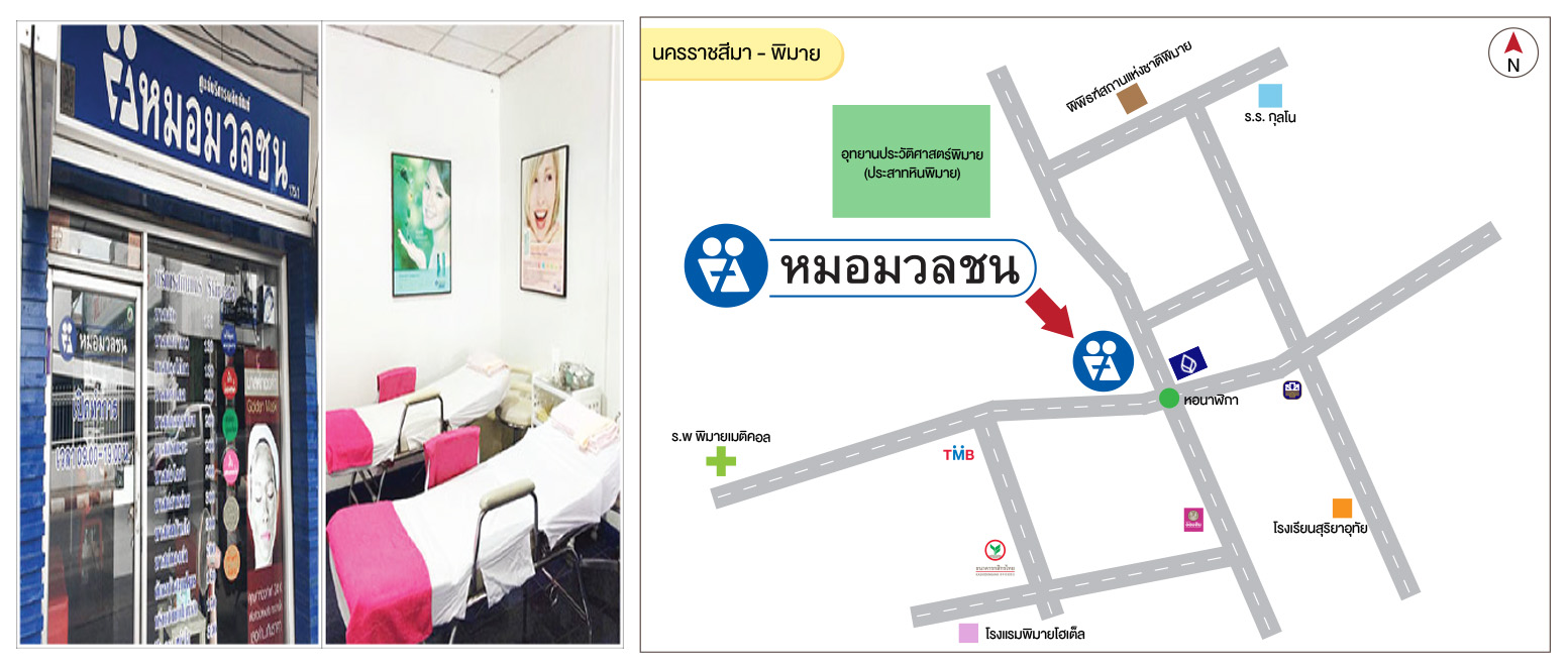 ศูนย์บริการผลิตภัณฑ์หมอมวลชน นครราชสีมา พิมาย
