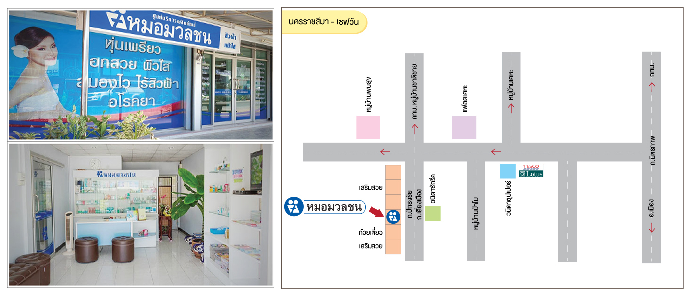 ศูนย์บริการผลิตภัณฑ์หมอมวลชน นครราชสีมา เซฟวัน