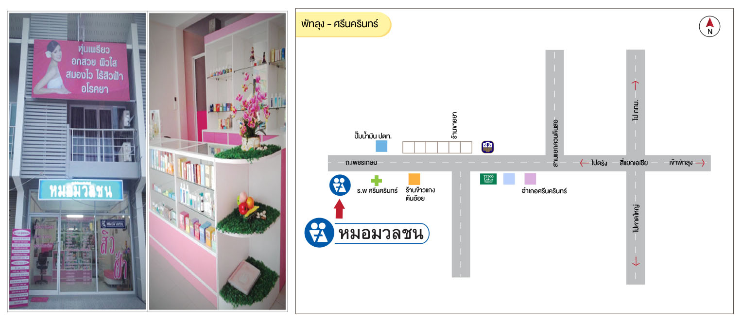ศูนย์บริการผลิตภัณฑ์หมอมวลชน พัทลุง - ศรีนครินทร์