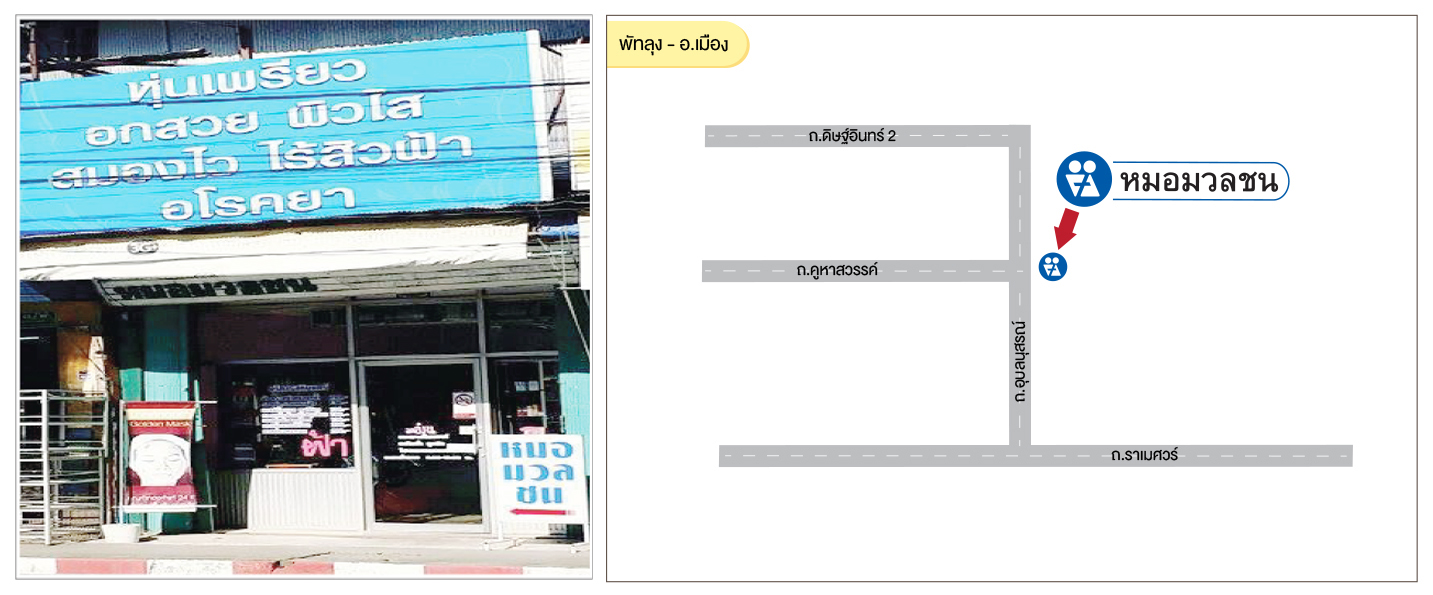 ศูนย์บริการผลิตภัณฑ์หมอมวลชน พัทลุง - อ.เมือง