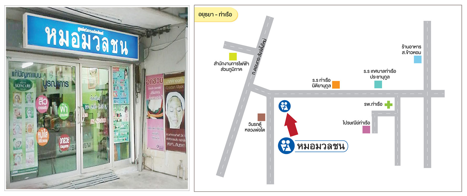 ศูนย์บริการผลิตภัณฑ์หมอมวลชน อยุธยา ท่าเรือ