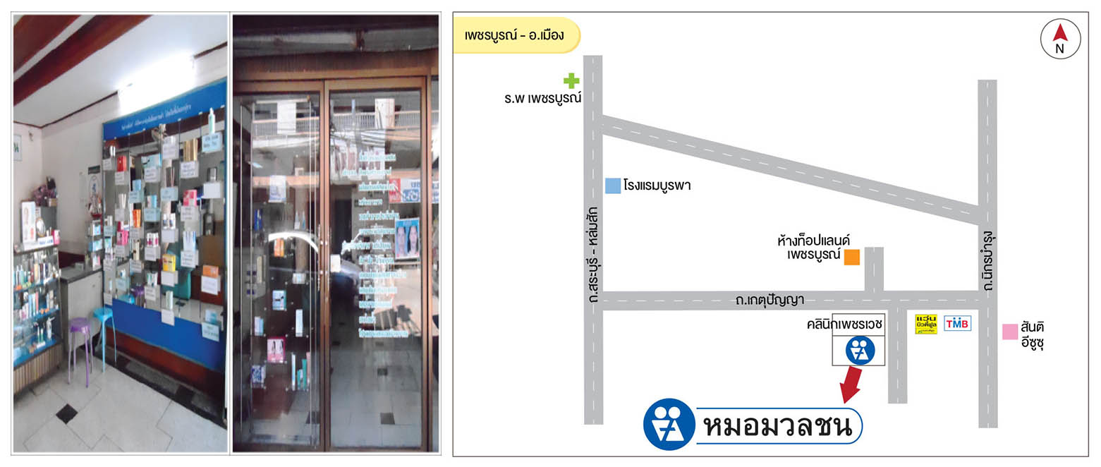 ศูนย์บริการผลิตภัณฑ์หมอมวลชน เพชรบูรณ์ อ.เมือง